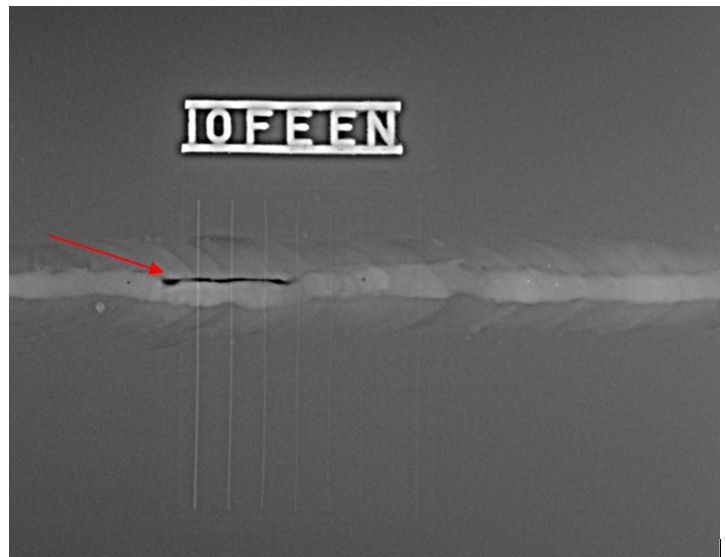 Radiographic Testing (RT)
